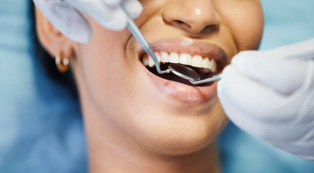 Best Urgent Care for Lost Fillings or Crowns in Columbus, OH